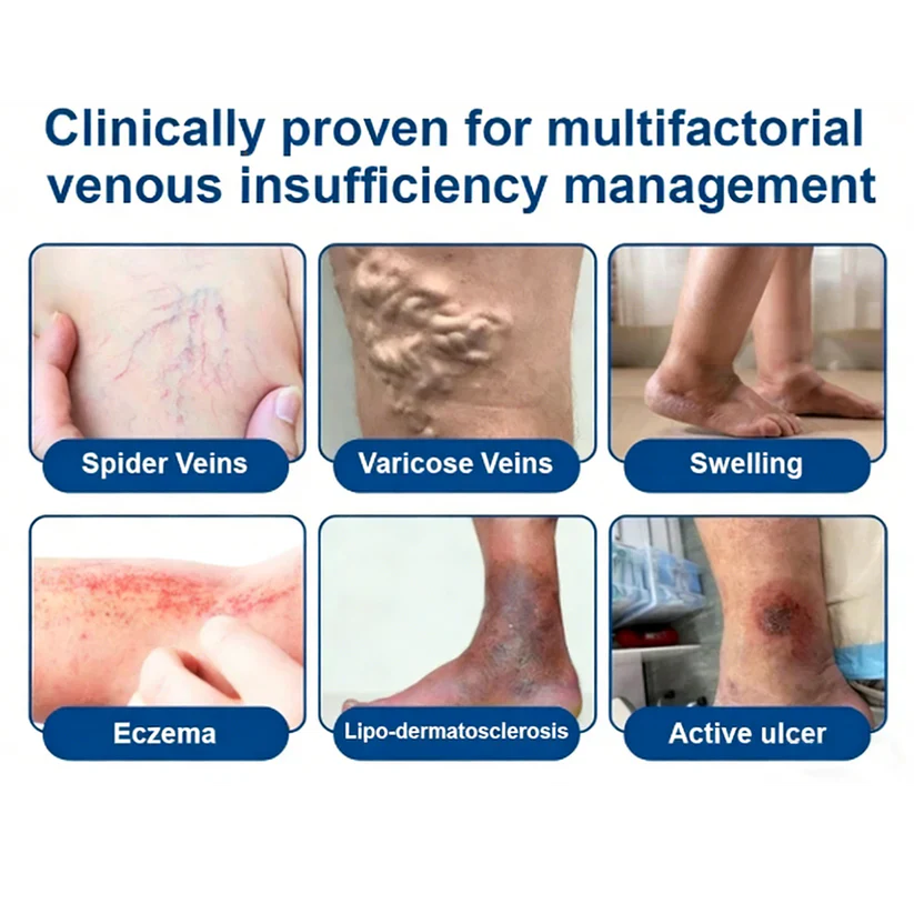 TAILEDEN® 𝑽𝗲𝗶𝙣 𝘾𝐨𝐧𝘁𝗼𝙪𝙧 𝙈𝙞𝐜𝐫𝒐𝒏𝒆𝗲𝗱𝗹𝙚 𝙋𝙖𝐭𝐜𝒉 𝒘𝒊𝘁𝗵 𝗔𝙙𝙫𝙖𝙣𝙘𝐞𝐝 𝐃𝒊𝒐𝒔𝗺𝙞𝐧 & 𝑯𝒆𝘀𝗽𝗲𝙧𝙞𝙙𝙞𝐧 𝐃𝒆𝒍𝒊𝒗𝗲𝗿𝙮🌿𝟕-𝐃𝐚𝐲 𝐕𝐢𝐬𝐢𝐛𝐥𝐞 𝐑𝐞𝐬𝐮𝐥𝐭𝐬 𝐟𝐨𝐫 𝐕𝐚𝐫𝐢𝐜𝐨𝐬𝐞 𝐕𝐞𝐢𝐧𝐬