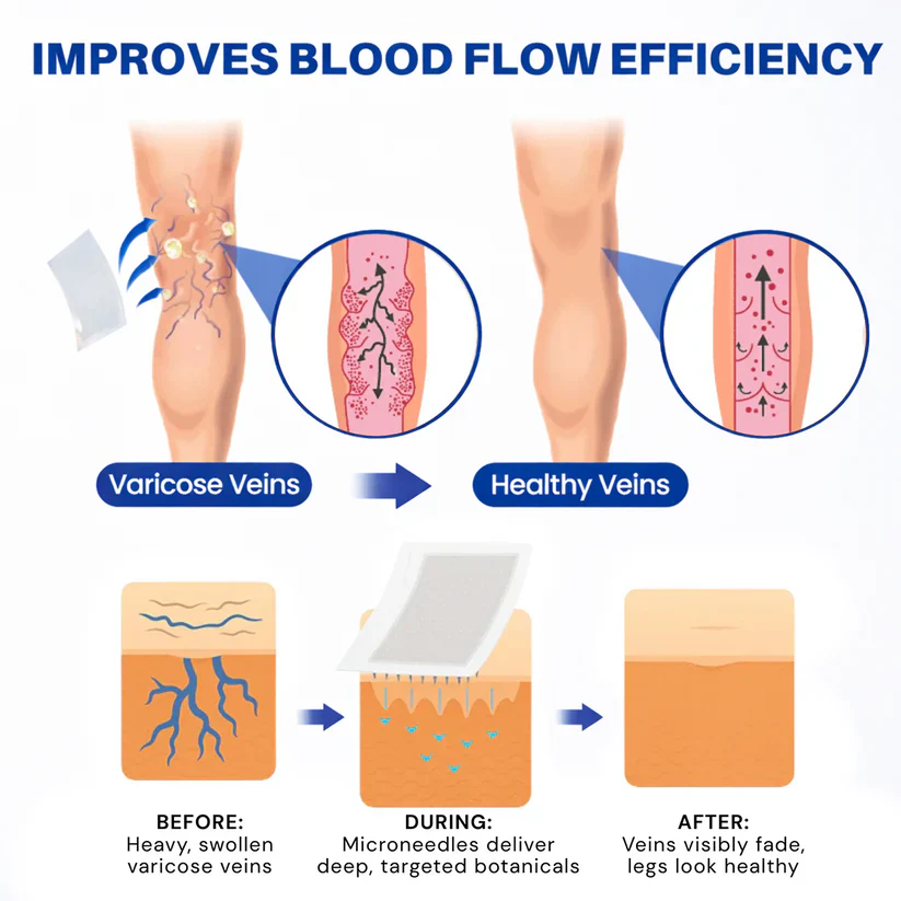 TAILEDEN® 𝑽𝗲𝗶𝙣 𝘾𝐨𝐧𝘁𝗼𝙪𝙧 𝙈𝙞𝐜𝐫𝒐𝒏𝒆𝗲𝗱𝗹𝙚 𝙋𝙖𝐭𝐜𝒉 𝒘𝒊𝘁𝗵 𝗔𝙙𝙫𝙖𝙣𝙘𝐞𝐝 𝐃𝒊𝒐𝒔𝗺𝙞𝐧 & 𝑯𝒆𝘀𝗽𝗲𝙧𝙞𝙙𝙞𝐧 𝐃𝒆𝒍𝒊𝒗𝗲𝗿𝙮🌿𝟕-𝐃𝐚𝐲 𝐕𝐢𝐬𝐢𝐛𝐥𝐞 𝐑𝐞𝐬𝐮𝐥𝐭𝐬 𝐟𝐨𝐫 𝐕𝐚𝐫𝐢𝐜𝐨𝐬𝐞 𝐕𝐞𝐢𝐧𝐬